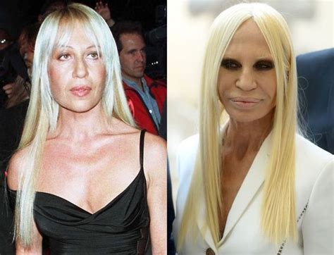 donatella versace avant chirugie|donatella versace without make up.